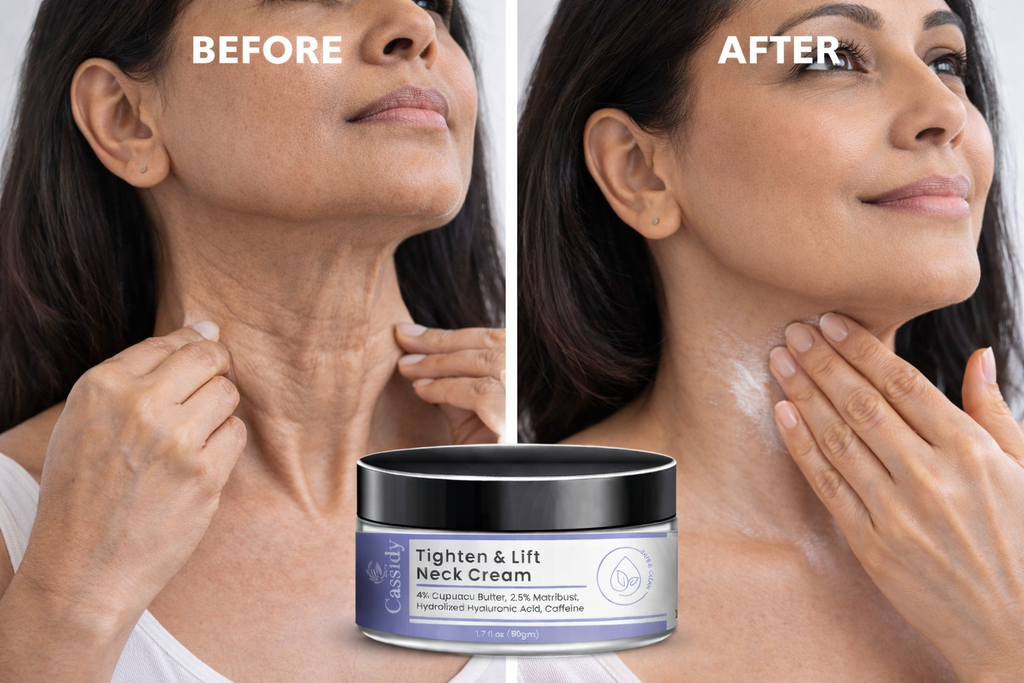 Skin Tighten & Lift Neck Cream ( Buy 1 Get 1 Free )